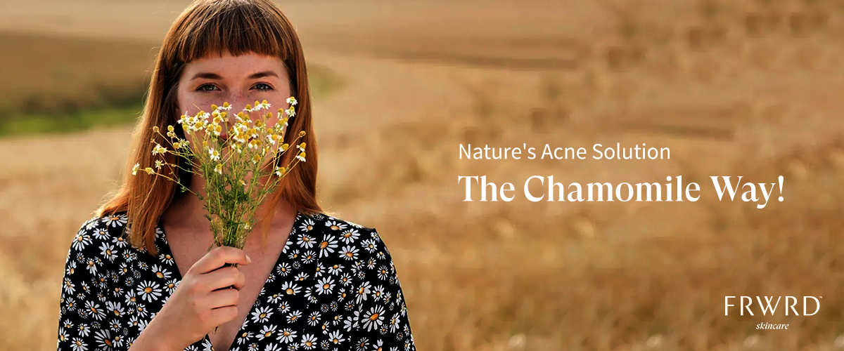 Chamomile for Calming Breakouts and Acne