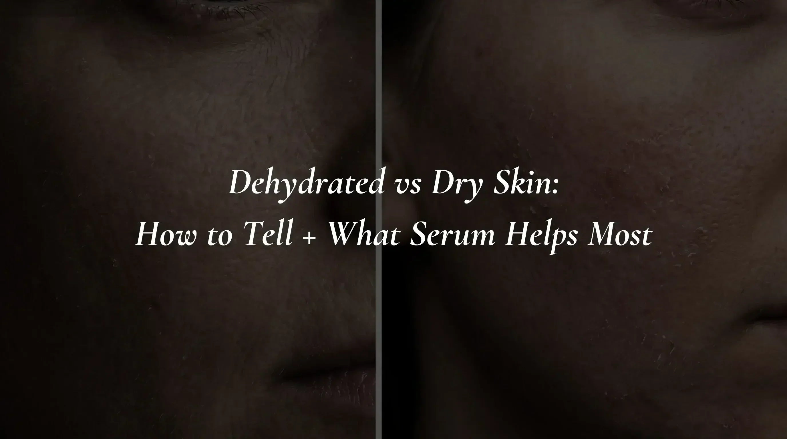 Dehydrated vs Dry Skin: How to Tell + What Serum Helps Most