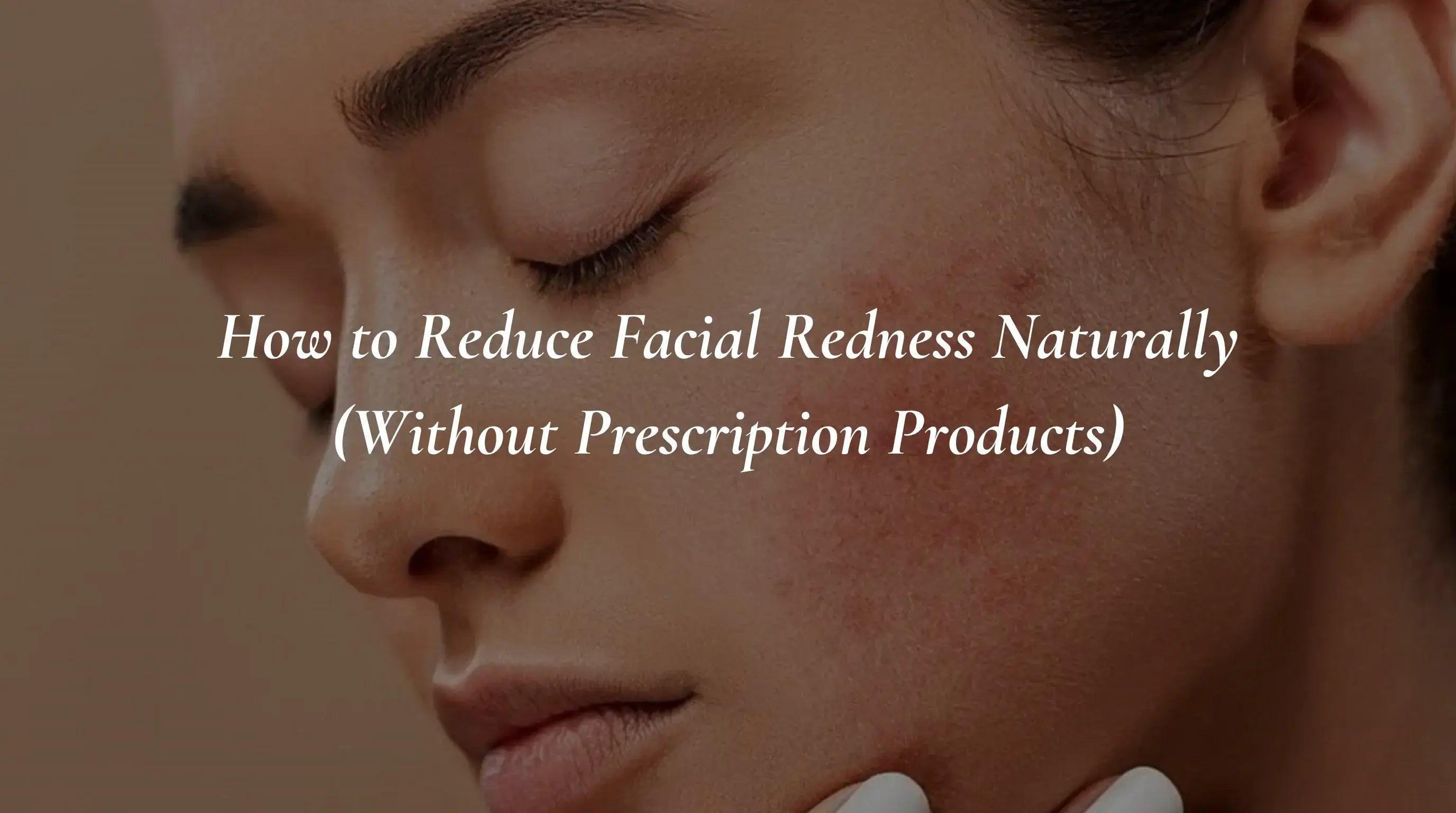 How to Reduce Facial Redness Naturally (Without Prescription Products)