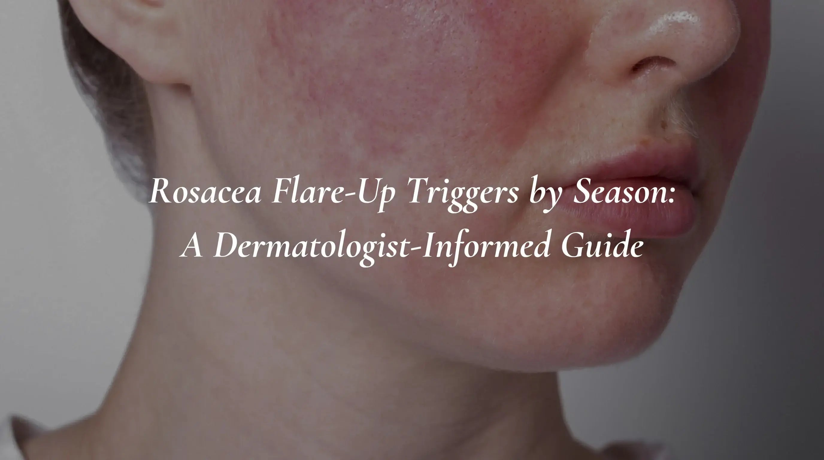 Rosacea Flare-Up Triggers by Season: A Dermatologist-Informed Guide