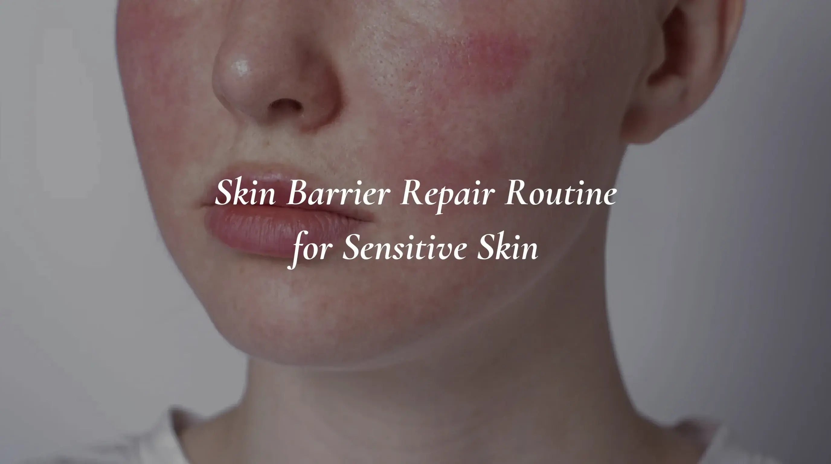 Skin Barrier Repair Routine for Sensitive Skin