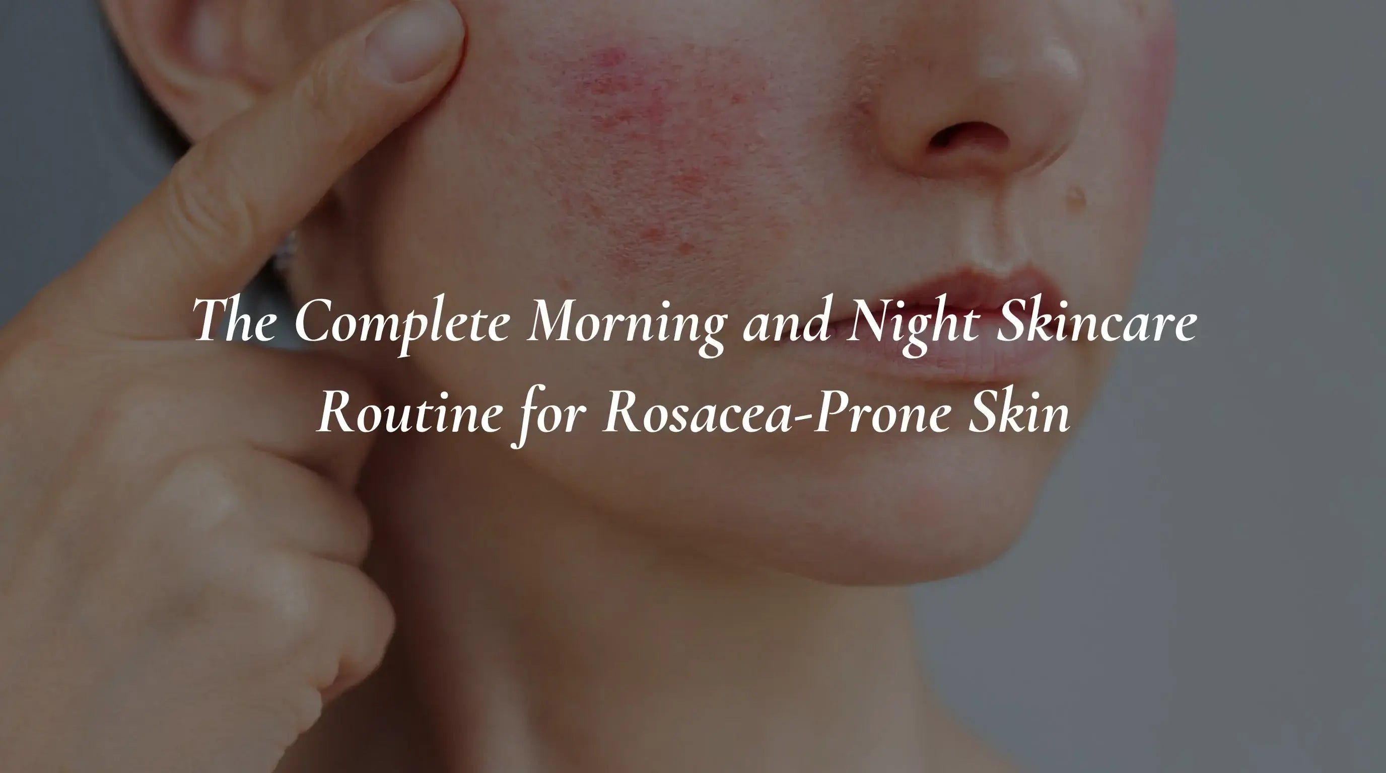 The Complete Morning and Night Skincare Routine for Rosacea-Prone Skin