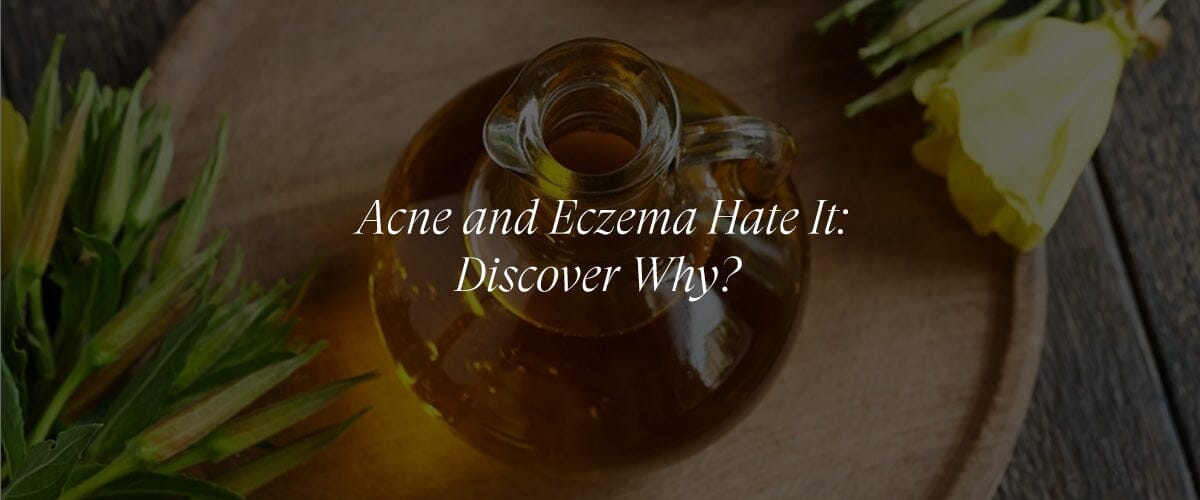 Evening Primrose Oil Benefits You Can’t Miss!